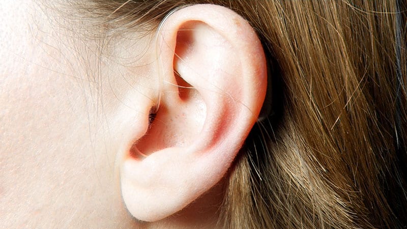 Nahaufnahme eines Ohres mit hellem Teint und braunem Haar, neutral
